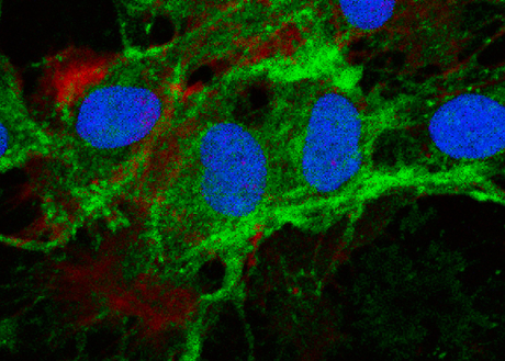 Mesenchymal stromal cells