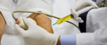 Image of stem cell treatment