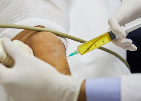 Image of stem cell treatment