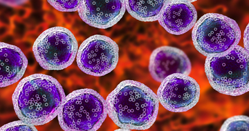 Large B-Cell Lymphoma