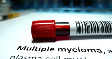 Multiple Myeloma
