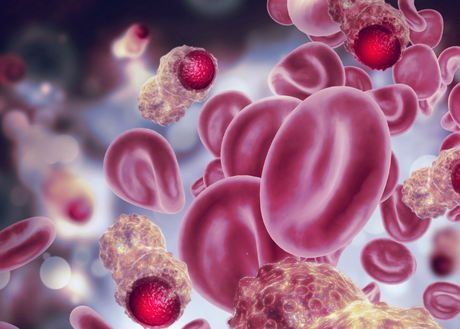 red blood cells under a microscope with signs of cancer